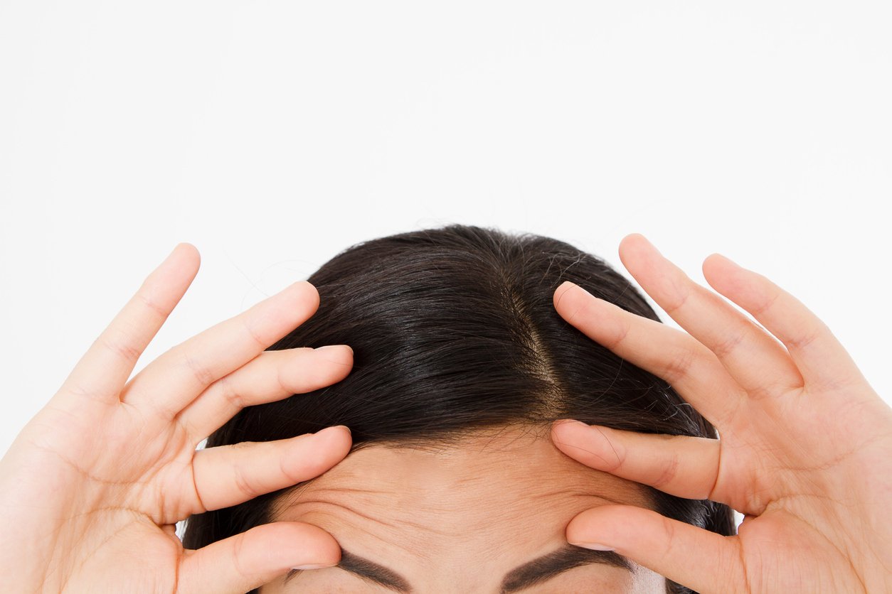 Macro Asian Woman face with wrinkles on the forehead. Collagen and face injections concept. Cropped image. Copy space and mock up. Girl with brown hair worried about thinning hair